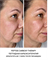 PEPTIDE CARBOXY THERAPY | Пептидная карбокситерапия - фото 9355